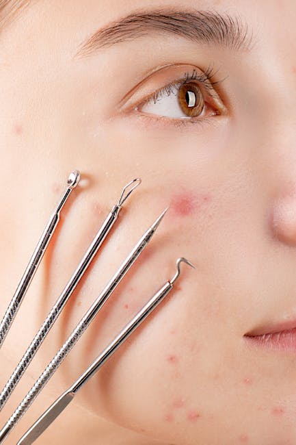 Close-up image of a person's face showing the right side, with light skin and brown eyes, partially visible lips, and clear skin with some acne. Several professional metal skincare or extraction tools with pointed and curved tips are held near the cheek, indicating a facial skincare or extraction procedure. The background is neutral and out of focus, emphasizing the face and tools. This image relates to skincare treatments and facial extraction procedures, which are relevant to health and beauty services. Man and Van Finsbury would emphasize careful handling of personal belongings during house removals, especially when involving valuable or delicate items like skincare products or personal care equipment, supporting efficient packing and moving processes.